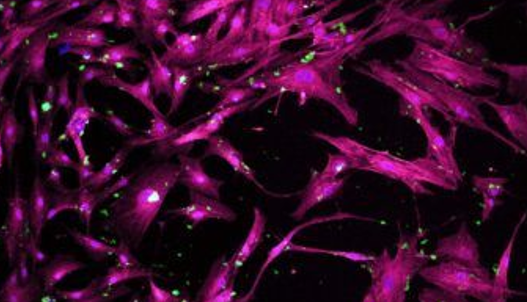 توسعه ی نانوذرات متخلخل برای پزشکی بازساختی توسط محققان رشته ی مهندسی